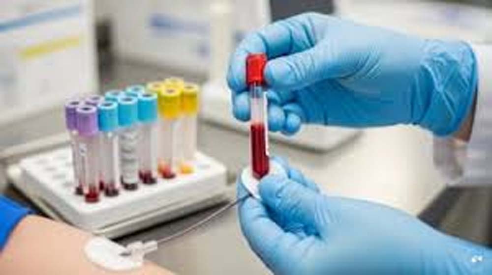 कर्नाटक में नया ब्लड ग्रुप ‘CRIB’ मिला:10 महीने की रिसर्च के बाद खोजा गया New blood group 'CRIB' found in Karnataka: Discovered after 10 months of research