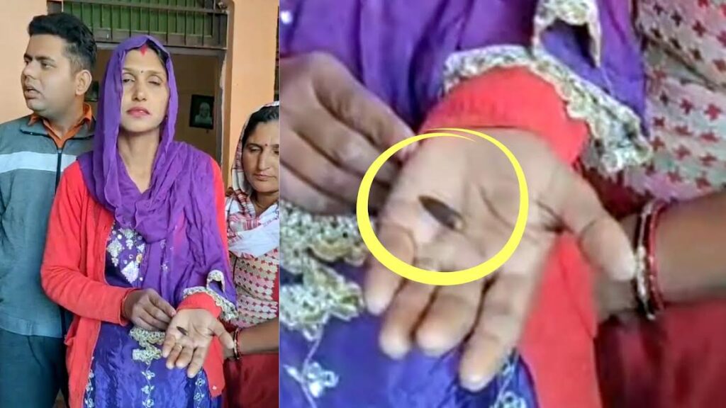A bullet was removed from a woman's body 20 years later, leaving everyone astonished.